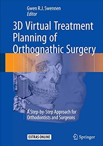 3D Virtual Treatment Planning of Orthognathic Surgery Gwen Swennen, ISBN-13: 978-3662473887