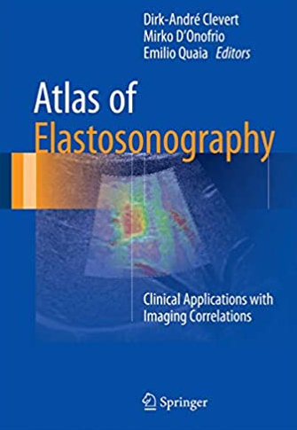 Atlas of Elastosonography: Clinical Applications with Imaging Correlations, ISBN-13: 978-3319441993