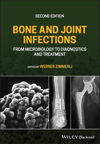 Bone and Joint Infections: From Microbiology to Diagnostics and Treatment (2nd Edition)