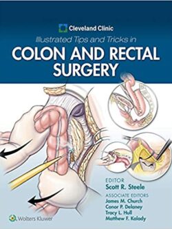 Cleveland Clinic Illustrated Tips and Tricks in Colon and Rectal Surgery