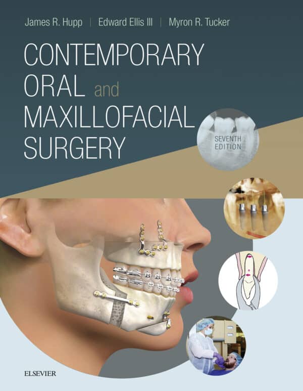 Contemporary Oral and Maxillofacial Surgery (7th Edition)