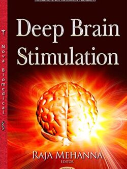 Deep Brain Stimulation By Mehanna R