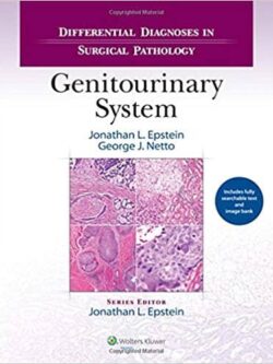 Differential Diagnoses in Surgical Pathology: Genitourinary System