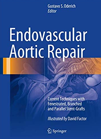 Endovascular Aortic Repair by Gustavo S. Oderich, ISBN-13: 978-3319151915