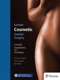 Female Cosmetic Genital Surgery: Concepts, Classification, and Techniques