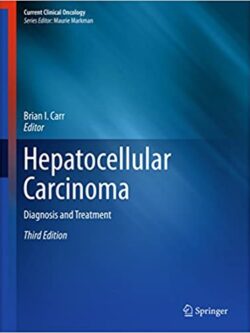 Hepatocellular Carcinoma: Diagnosis and Treatment (3rd Edition)