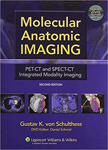 Molecular Anatomic Imaging: PET-CT and SPECT-CT Integrated Modality Imaging (2nd Edition)