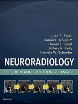 Neuroradiology: Spectrum and Evolution of Disease