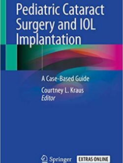 Pediatric Cataract Surgery and IOL Implantation: A Case-Based Guide