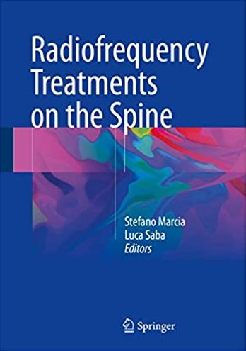 Radiofrequency Treatments on the Spine Stefano Marcia, ISBN-13: 978-3319414614