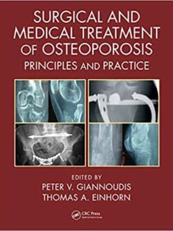 Surgical and Medical Treatment of Osteoporosis: Principles and Practice