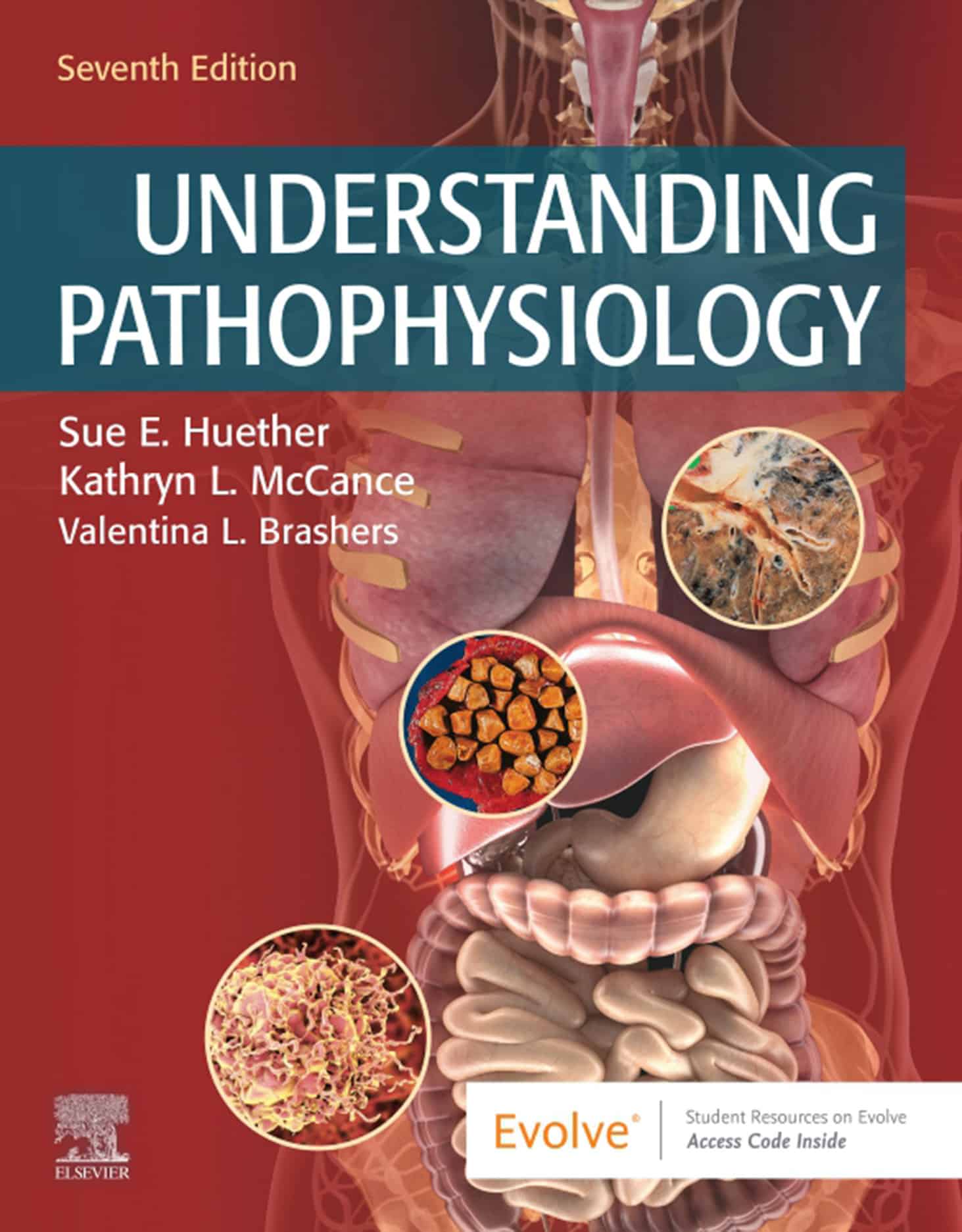 Understanding Pathophysiology (7th Edition)