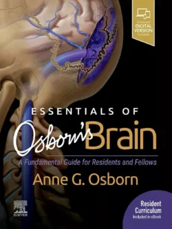 Essentials of Osborn’s Brain 